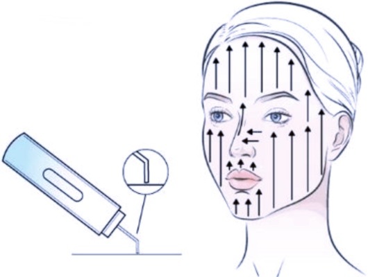Ultrazvuková špachtľa Concept Perfect Skin PO2060 Concept Perfect Skin PO2060