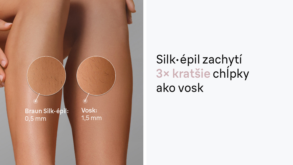 Chĺpky na nohe