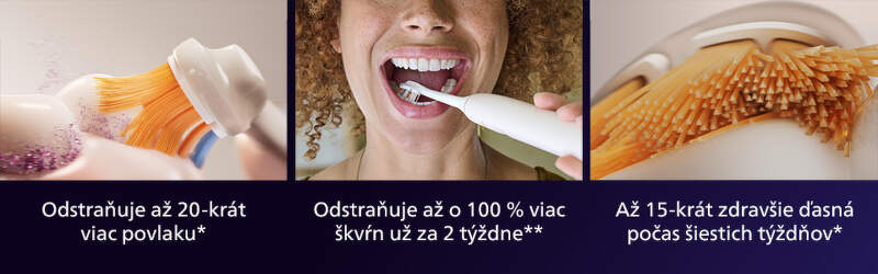 Náhradné hlavice Philips Sonicare Premium All-in-One HX9096/87 (6 ks) biela