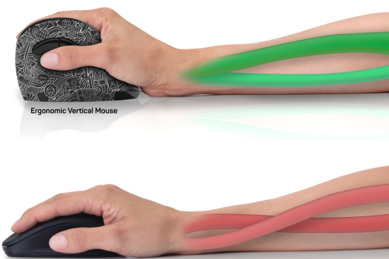 Myš Connect IT Doodle, vertikálna, ergonomická čierna