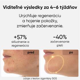 LED maska JOVS JM2C hnedá

 obrázok produktu 6 z 9