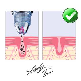 Čistič pórov Vigan Lady TWO biely

 obrázok produktu 6 z 9