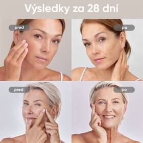 LED maska JOVS JM2P hnedá

 obrázok produktu 8 z 10