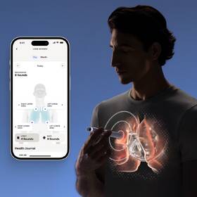 Teplomer Withings BeamO 4-in-1 MultiScan biely

 obrázok produktu 4 z 9