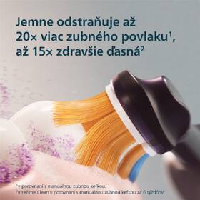 Zubná kefka Philips HX8311/12 čierny

 obrázok produktu 2 z 10