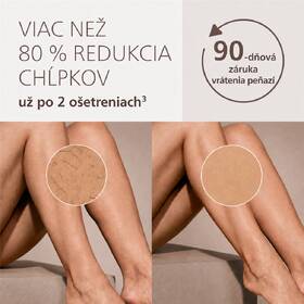 Epilátor Philips BRC344/00 biely

 obrázok produktu 5 z 11