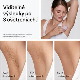 Epilátor Braun IPL1100 ružový

 obrázok produktu 2 z 10