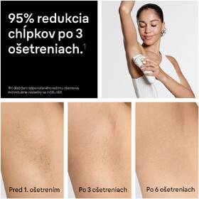 Epilátor Braun IPL5210 biely/zlatý

 obrázok produktu 5 z 10