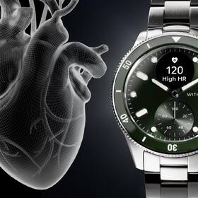 Inteligentné hodinky Withings Scanwatch Nova 42 mm strieborné/zelené

 obrázok produktu 5 z 7