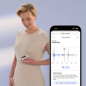 Teplomer Withings BeamO 4-in-1 MultiScan biely

 obrázok produktu 5 z 9