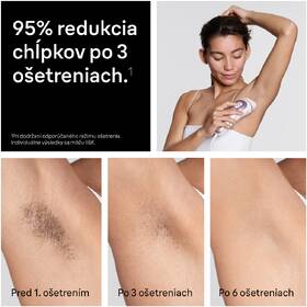 Epilátor Braun IPL7431 biely/bronzový

 obrázok produktu 6 z 12