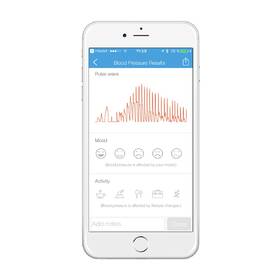 Tlakomer na zápästie iHealth VIEW BP7 biely

 obrázok produktu 13 z 15