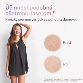 Epilátor Braun IPL7253 
