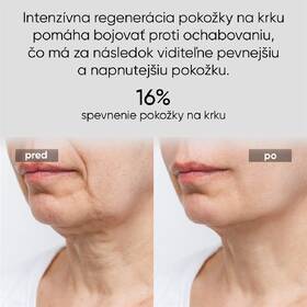 LED maska JOVS JNL1 hnedá

 obrázok produktu 4 z 8