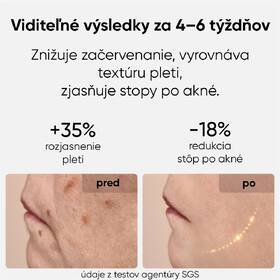 LED maska JOVS JM2C hnedá

 obrázok produktu 4 z 9