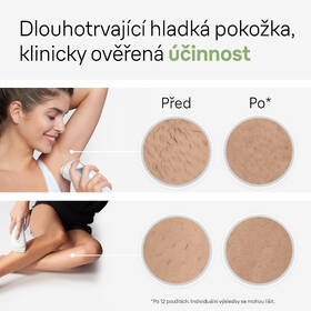 Epilátor Braun IPL3122 

 obrázok produktu 5 z 8