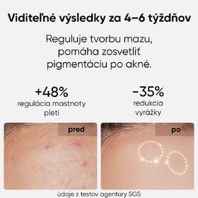 LED maska JOVS JM2C hnedá

 obrázok produktu 5 z 9