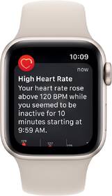 Inteligentné hodinky Apple GPS 40mm hviezdne biely hliník - hviezdne biely športový remienok 

 obrázok produktu 4 z 7